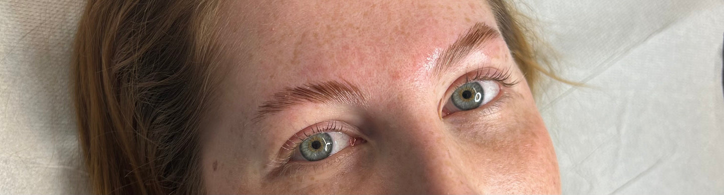 Brow Lifting